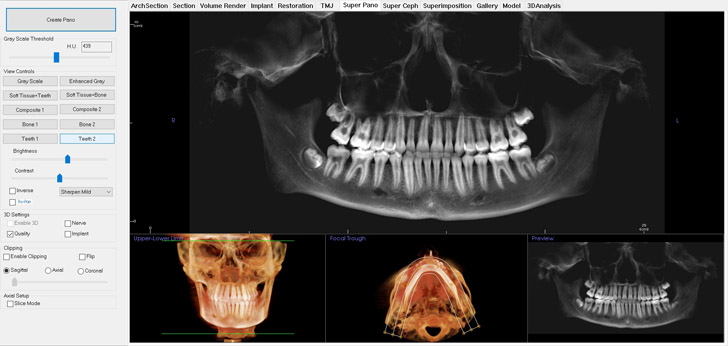 Cone Beam CT